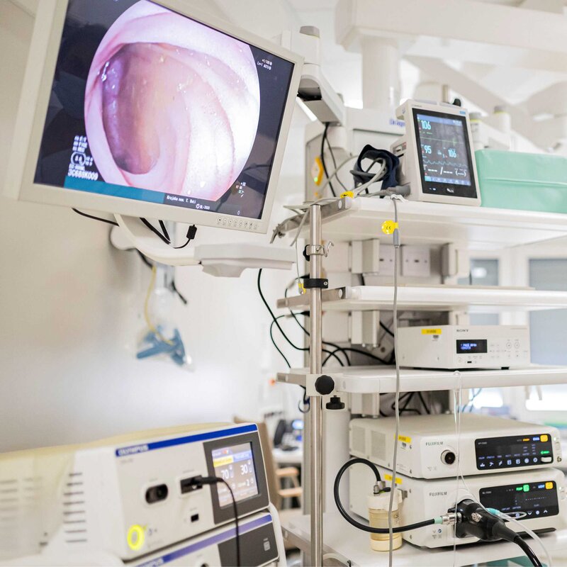 Digestivní endoskopie v KNTB